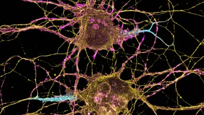 microscopic view of neurons