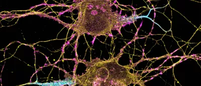 microscopic view of neurons